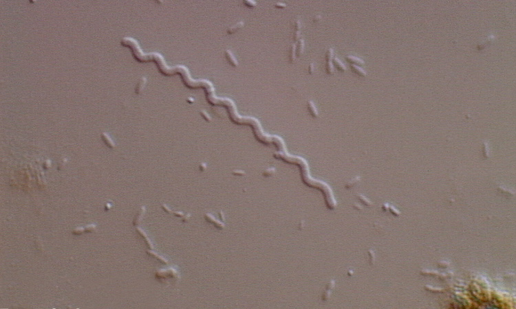 Biodiversité - Les Procaryotes ou Monères - 1mn 39s
